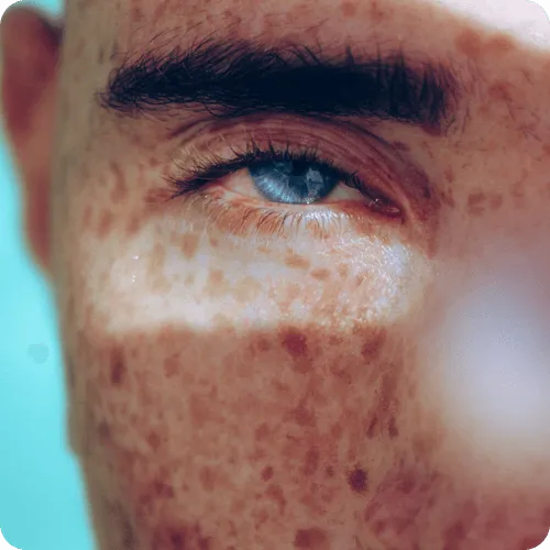 Image of a man with freckles on his face, smiling warmly, showcasing his unique features